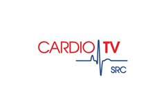 Cardio TV SRC